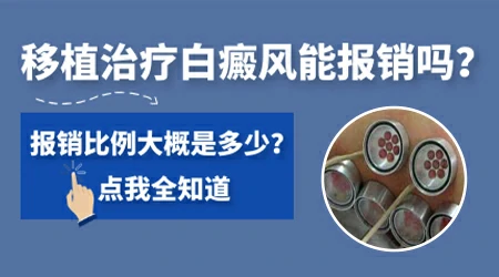 植皮手术治疗白癜风成功率大概有多少