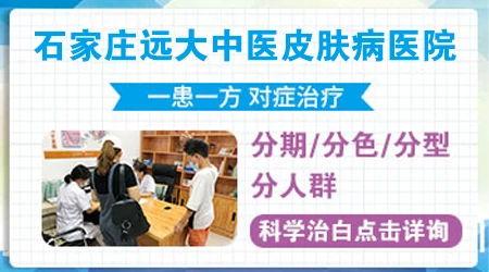 石家庄治疗白癜风哪家医院专业