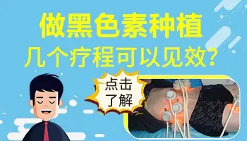 白癜风细胞移植一个月后还没有看到效果
