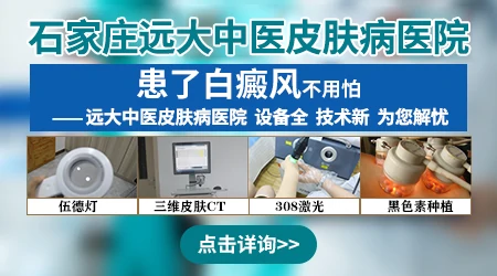 石家庄哪家医院治疗白癜风设备齐全