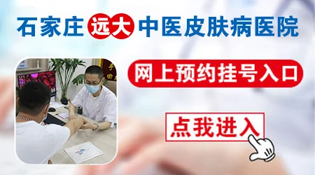 石家庄中医皮肤病医院预约挂号平台