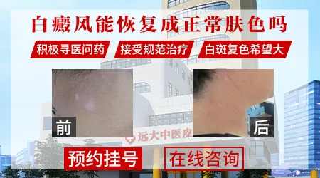 白癜风能不能完全恢复正常皮肤