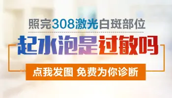 白癜风照光会引起皮肤过敏吗