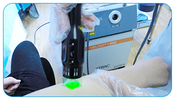 白癜风光疗后怎么感觉变大了