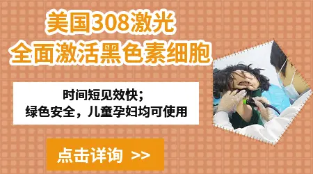 儿童白癜风早期能治好吗 有什么安全的治疗方法