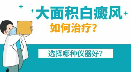 大面积白癜风怎么用药治疗更划算