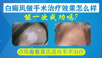 白癜风黑色素种植手术一次可以成功吗