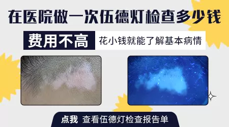 皮肤照伍德灯边界欠清