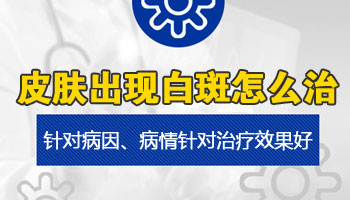 邯郸白斑的治疗方法 邯郸治白癜风好的医院