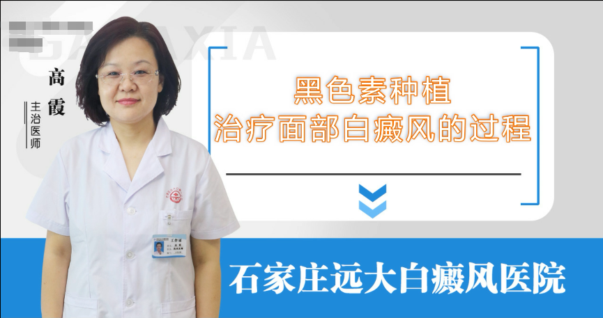 黑色素种植治疗面部白癜风的过程