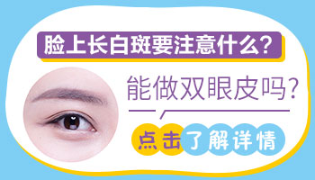 白癜风治愈后能做双眼皮手术吗