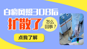 白癜风在照射308过程中扩散是什么原因