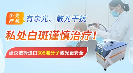 私处白癜风能照射紫外线灯吗