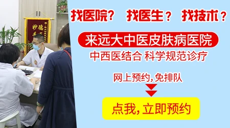 白癜风从浅白到深白多长时间