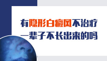 隐形白癜风有一辈子都不显形的吗