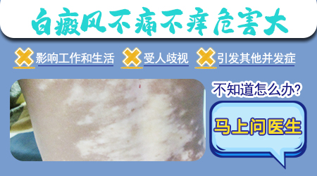 面部白斑两个月了不痒是什么