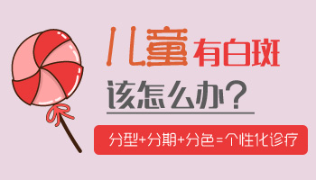 儿童白斑是什么 一般要做几项检查