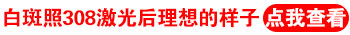 隐形白斑多久能显出来 隐形白癜风治疗方法