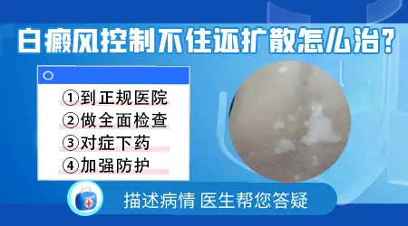 白癜风控制不住还在扩散怎么治