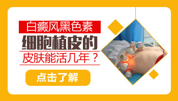 白癜风植皮后怎么知道成功不成功