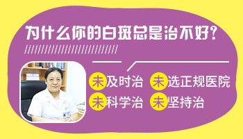 白癜风一边长一边好是为什么