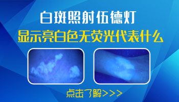 照伍德灯白斑亮白色