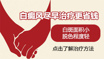 白癜风一般多久可以治愈