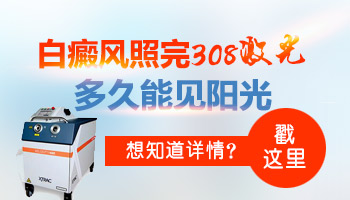 白癜风照了308激光还不长黑色素怎么回事