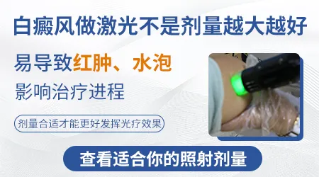 白癜风照光后发红脱皮是不是过量