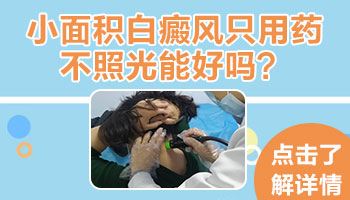 如果不用308治疗白癜风吃药能根治白斑吗