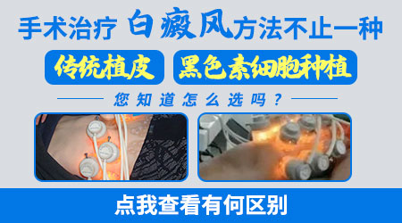 白癜风做手术的部位是不是不能使劲搓