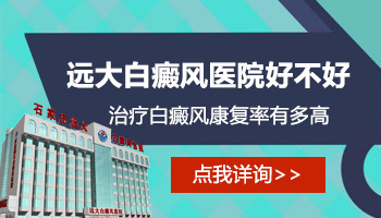 疫情期间白癜风医院上班吗