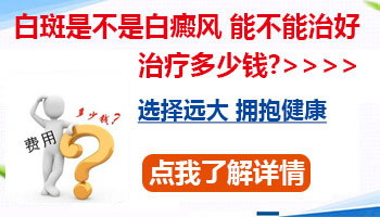 白癜风治好大概要多少钱