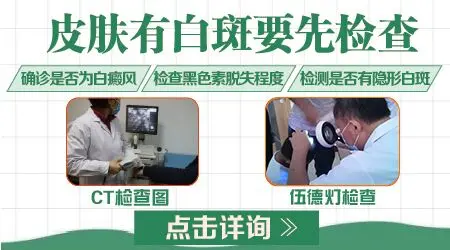 后背长了好几块白块是怎么回事