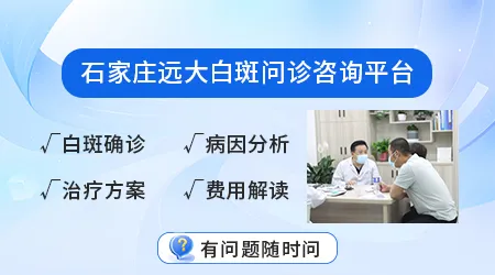 石家庄哪家医院白癜风做308光疗性价比高