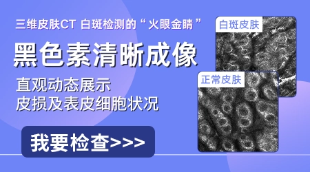 皮肤CT不同医院结果会不一样吗