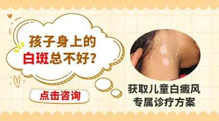 儿童腿上白斑用什么药膏ZUI有效