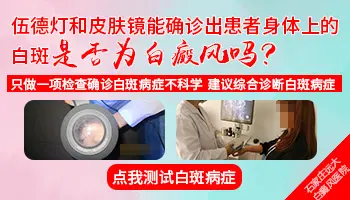 白癜风在皮肤镜下是什么样的