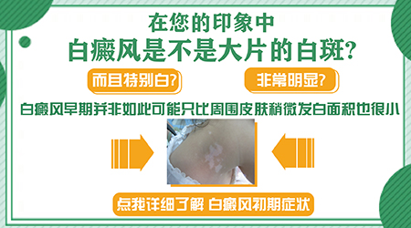 耳朵下方皮肤为什么是白色的