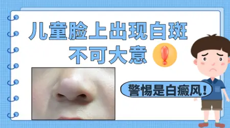 儿童脸上长白斑图片