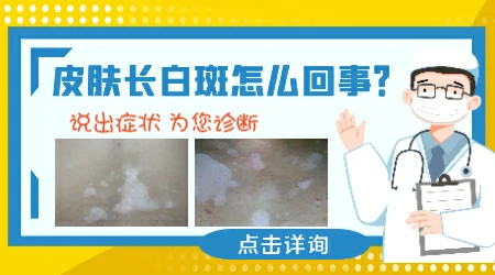 怎么分辨白斑是什么 脸上长白斑的症状