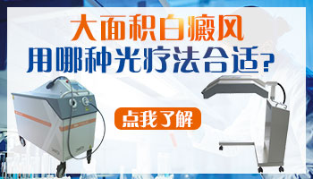 面积大的白癜风怎么照光