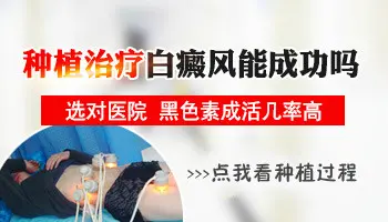 手指白癜风种植几率高不高 手指白斑治好案例