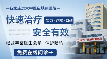 石家庄白癜风专科医院哪家口碑好