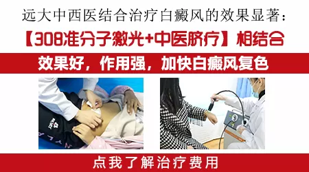 白癜风脐疗治疗费用