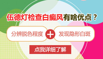 肚脐附近白一块 白斑不痒不起皮是什么