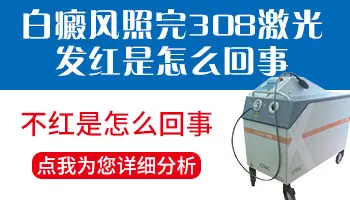 白癜风照308激光一段时间后不红没反应怎么办