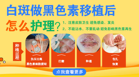 白癜风植皮手术后肤色深怎么改善