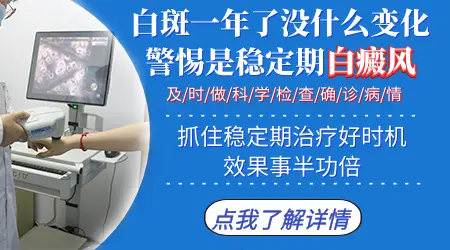 脚背白斑一两年没变化是不是稳定期