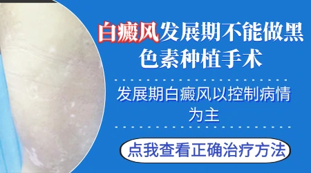 进展期白斑能不能直接做光疗或者种植手术